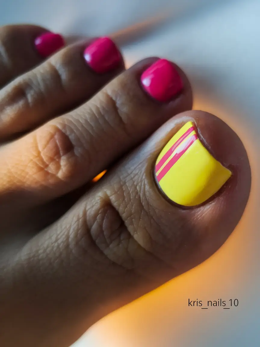 summer toe nails ideas 2025 Sunbeam Stripes